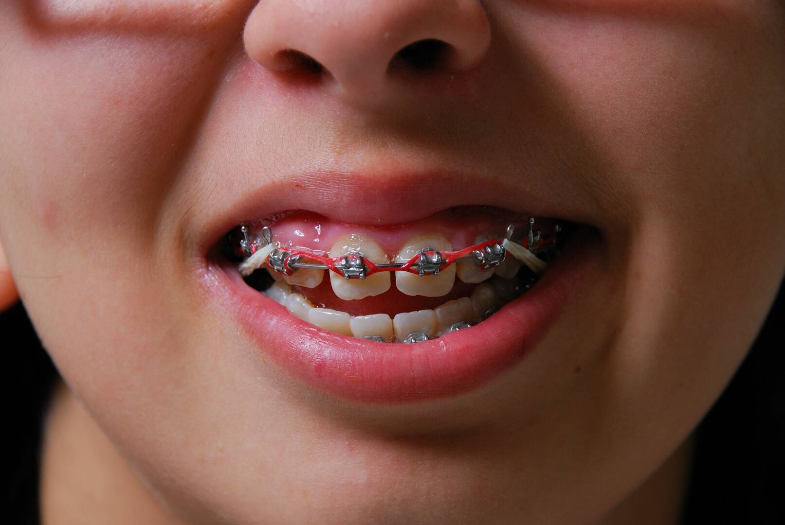 Dental Implants Periodontist Tucson AZ